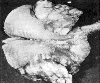 Poumon d'un poulain mort de la broncho-pneumonie à Rhodococcus equi. Les gros abcès, si caractéristiques de la maladie, ont probablement mis de trois à quatre semaines à se développer. Un traitement antibiotique efficace pendant cette même durée aurait pu sauver le poulain.