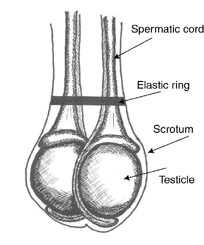Elastic band at top of testicles.