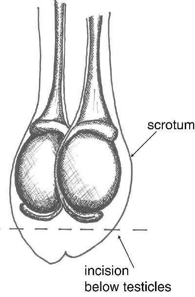 Incision method B.