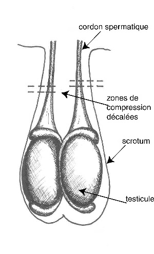 Zones de compression — Castration à l'aide de la pince de Burdizzo.