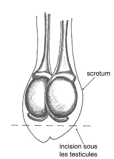 Méthode d'incision B.