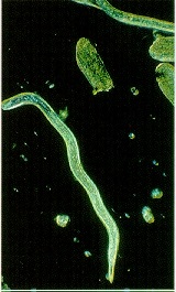 Adult female root-lesion nematode.