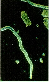 Racine endommagée par un nématode adulte femelle